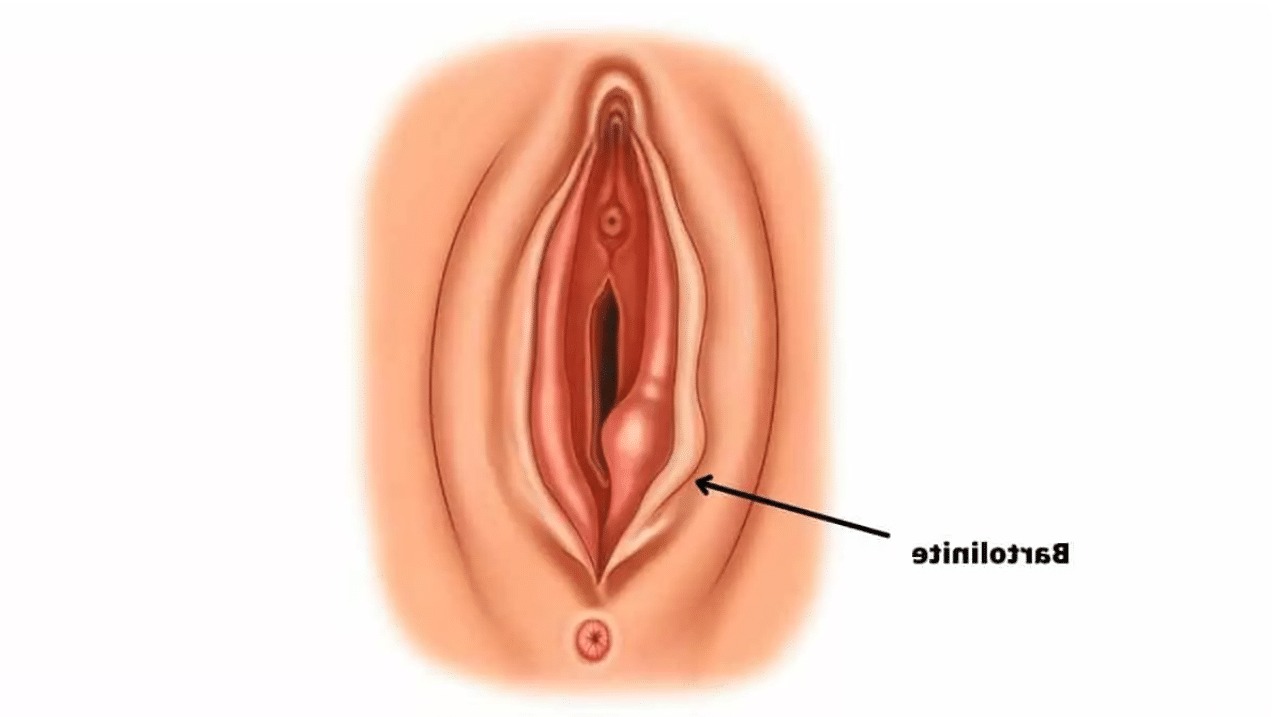 bartholinite-cause-emotionnelle
