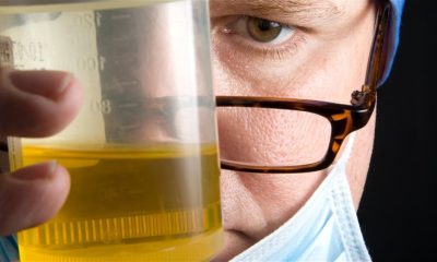 urine-malodorante-sans-douleur