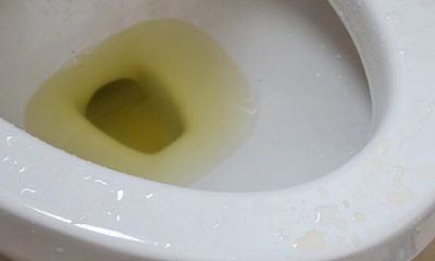 urine-qui-sent-le-poisson