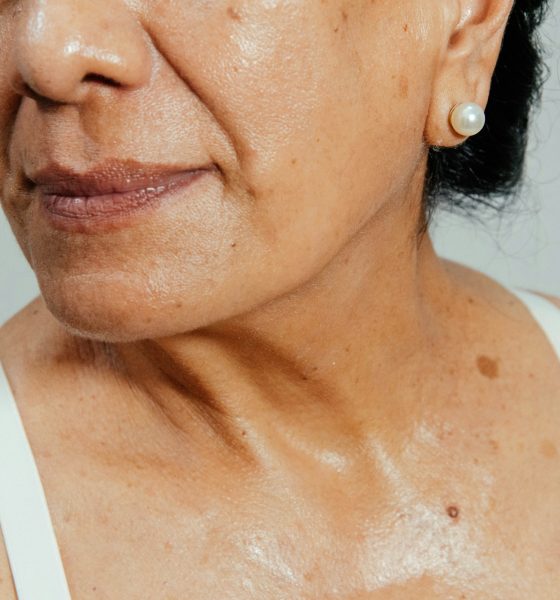 pore-dilates