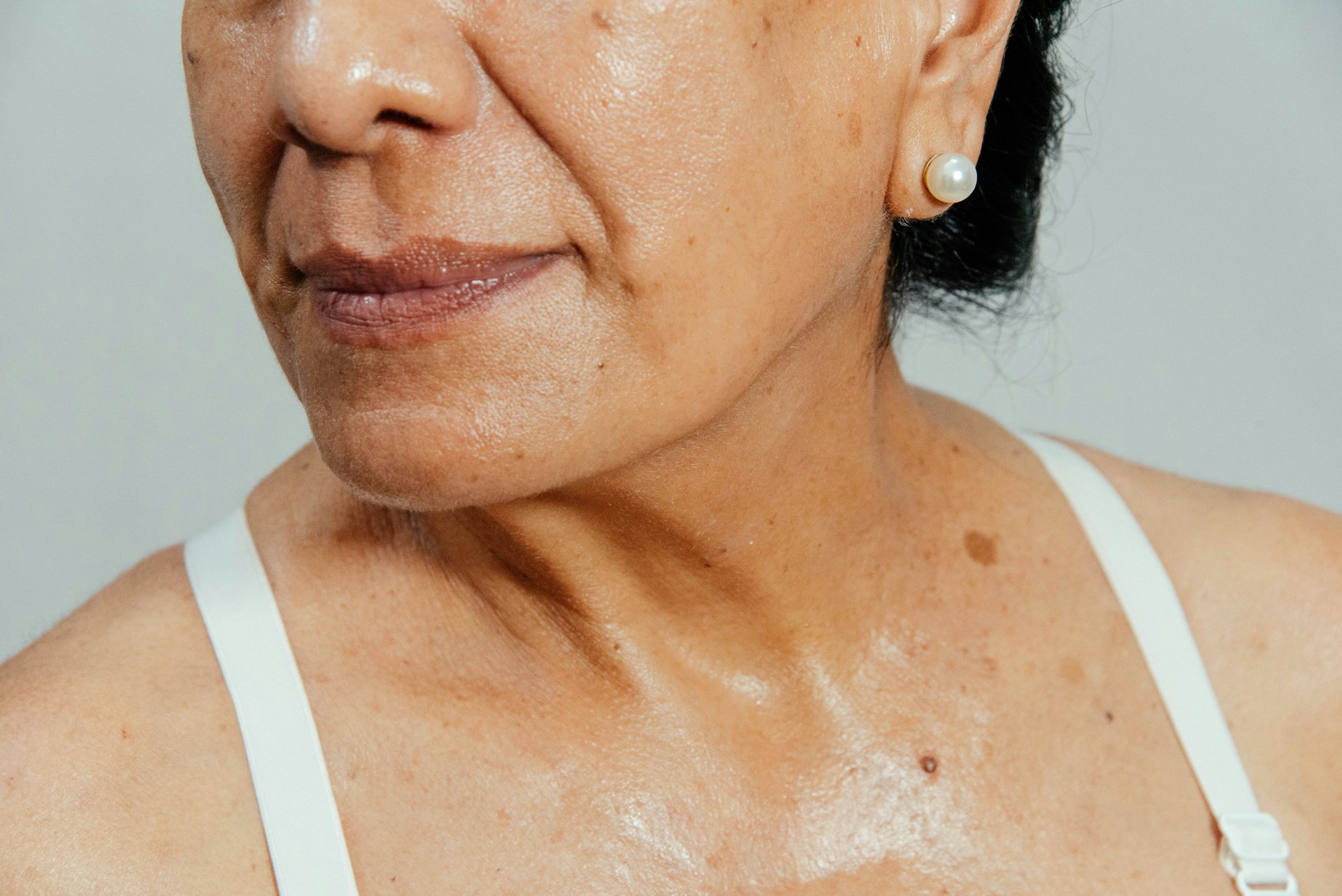 pore-dilates
