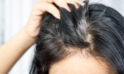 cheveux-blancs-causes-et-solutions