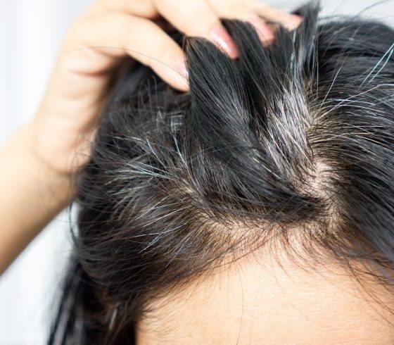 cheveux-blancs-causes-et-solutions