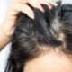 cheveux-blancs-causes-et-solutions