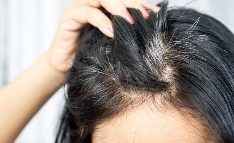 cheveux-blancs-causes-et-solutions