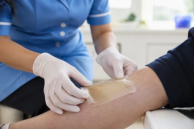 Comparatif pansement cicatrisant : application d'un pansement hydrocolloïde par une infirmière sur une jambe.