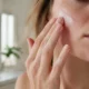Pourquoi la peau du visage pèle-t-elle et comment la soulager ?