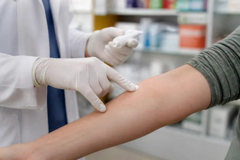 Mains d'un pharmacien appliquant une crème sur de petits points rouges sur la peau