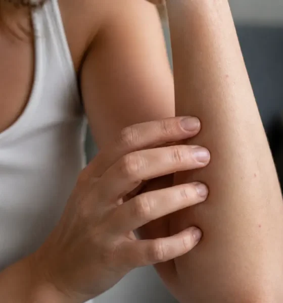 Petits points rouges sur la peau : de quoi s'agit-il vraiment ?
