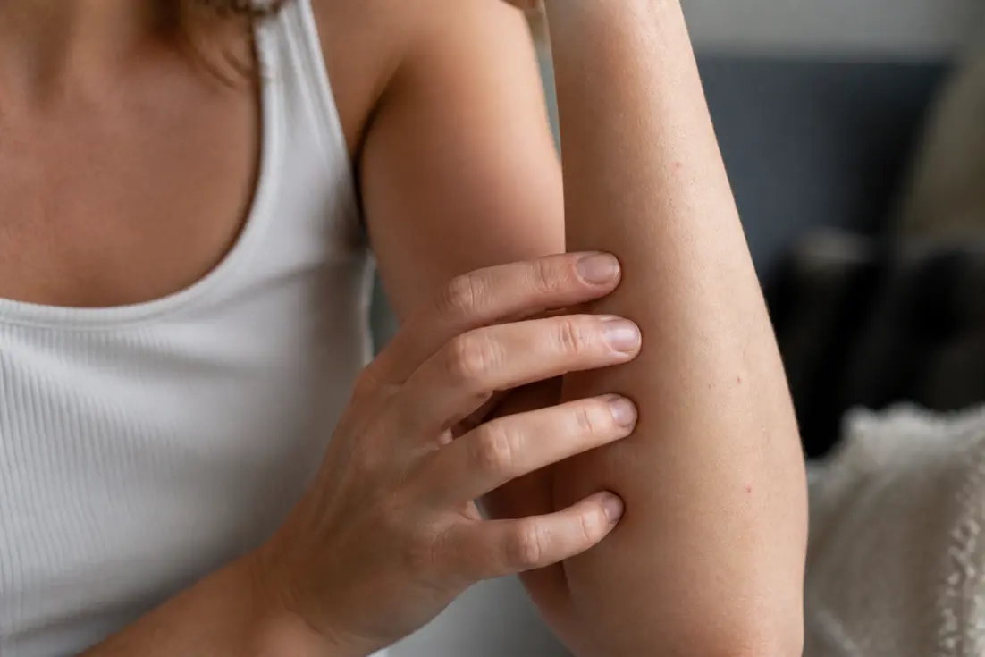 Petits points rouges sur la peau : de quoi s'agit-il vraiment ?