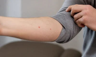 Taches rouges sur la peau : comment les reconnaître et quand s'inquiéter ?
