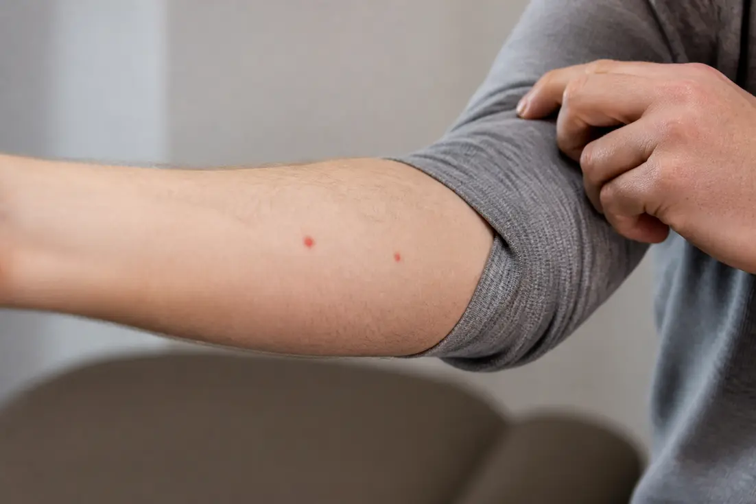 Taches rouges sur la peau : comment les reconnaître et quand s'inquiéter ?