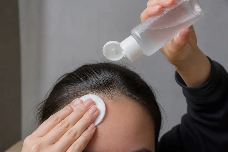 Application d'un coton imbibé d'acide salicylique pour éliminer les comédons fermés sans cicatrice